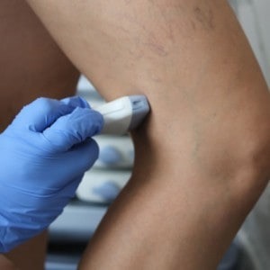 Le problematiche della circolazione da affrontare senza superficialità. I consigli del dottor Claudio Negro, operativo nel centro Calabrese di Cavallino - Corriere Salentino