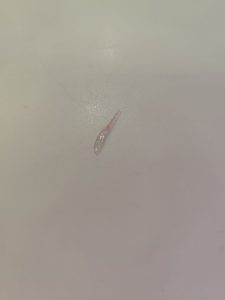 Nella pizza trova un pezzo di vetro: 36enne in ospedale per una lesione alla gola. “Dopo 4 mesi ancora in terapia” - Corriere Salentino