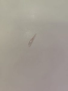 Ingoia un pezzo di vetro mentre mangia una pizza: cliente in ospedale, a processo titolare pizzeria - Corriere Salentino