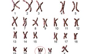 La scienza prova a cambiare un cromosoma. Noi abbiamo già cambiato sguardo? - Corriere Salentino