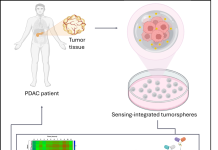 tumore del pancreas: sensori “intelligenti” nei tessuti misurano la risposta alla chemioterapia Salute - Corriere Salentino