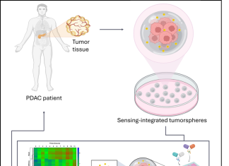 Tumore del pancreas: sensori “intelligenti” nei tessuti misurano la risposta alla chemioterapia